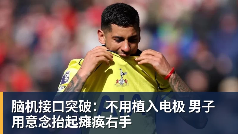 脑机接口突破：不用植入电极 男子用意念抬起瘫痪右手